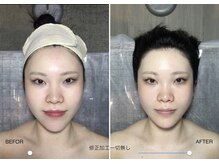 自然美人/小顔コルギの効果