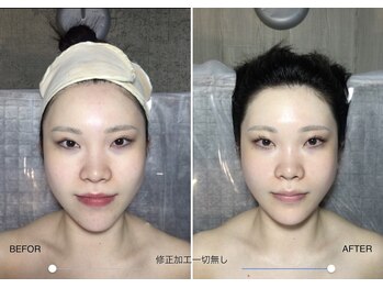 自然美人/小顔コルギの効果