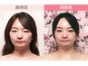 【3回セットで集中小顔ケア】小顔矯正ベーシック×3回  ￥45,000⇒￥39,000