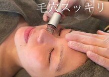 チッチ(Chicchi)