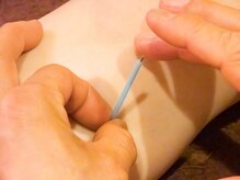 ウ～さんの中医鍼灸院の雰囲気（道具外のチカラ）