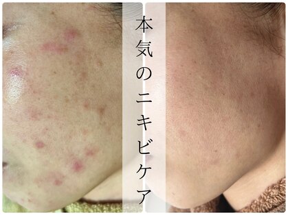 リノ(Lino)の写真