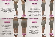 ビジリンヌ