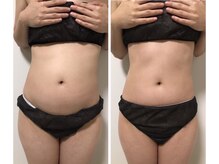 リズビー(Lisbe)/薬院/リンパ/痩身