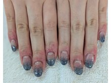 ネイルサロンひまわり/【深爪矯正・2】長さ出し・ラメ