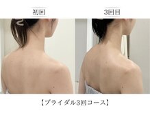 フロリール アザブジュウバン(FlorirAzabujuban)の雰囲気(お写真写りバッチリのスタイルへ【麻布十番/痩身/ブライダル】)