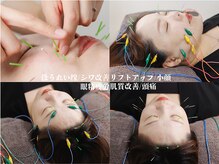 治楽院ようの雰囲気（お悩みに合わせた美容鍼施術でしっかり結果につなげます！）