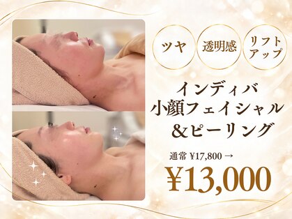 ミーティスの写真
