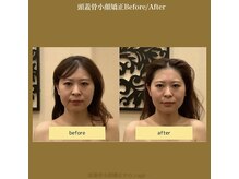 アジール 新潟市(agir)/Before/After画像