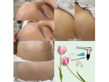 ラストミニットサロン 東京の雰囲気（諦めていた妊娠線、傷痕などもプロセルにお任せ◎）