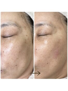 スーン(soon)/クルクル、トントン♪