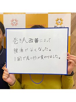 わいわい整体院/巻き爪改善の喜びの声