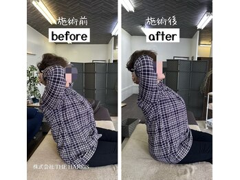 由利本荘整体院/施術ビフォーアフター（首腰）