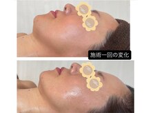 リラ鍼灸接骨院(Rela鍼灸接骨院)/レモンボトル