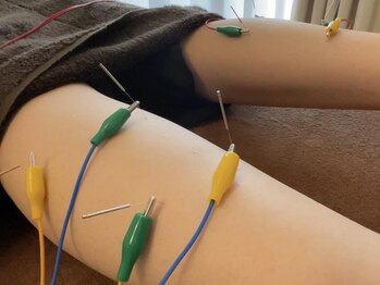 鍼灸 整体院 スズユ(SUZUYU)/【北浜/鍼灸/整体/むくみ改善】