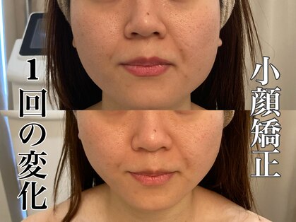 ビジュープラス 広島店(Bijou+)の写真