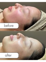 アール(R;)/花粉による影響