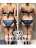 【春痩せ応援企画】1ヶ月で -4kg！《全身施術》最短・本気で痩せたい方へ！