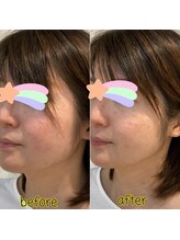 ピエール ナリタイラボ(Piel NARITAI LABO)/小顔整体