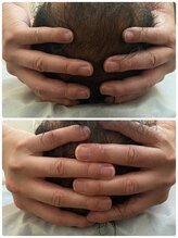 リヴィラ(Revilla)/ヒマラヤンドライヘッド