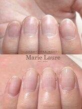 マリーロール 淀屋橋本店(Marie Laure)/自爪育成/深爪矯正/ネイルケア