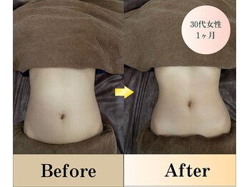 ニコ 千葉店(NICO)/千葉駅エリア注目の痩身サロン