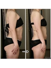 ノリスズ(NORI SUZU)/脂肪分解して痩身に導くカッサ術