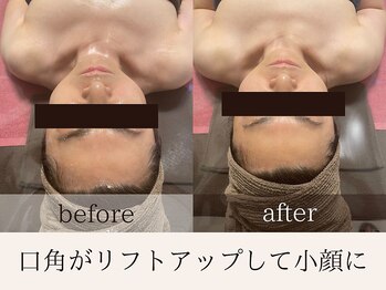 ティアラ/before after　