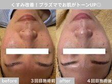 サロン ビュー(salon view)/50代女性〈くすみ悩み〉　