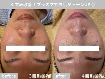 サロン ビュー(salon view)/50代女性〈くすみ悩み〉