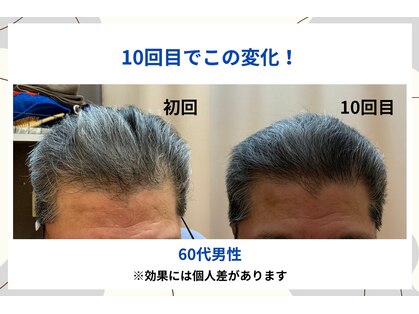 福山発毛センターの写真