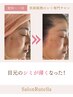【リピーター様限定】肌質改善コース
