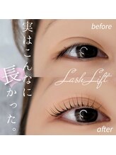 シルミエ(cilumie)/次世代ラッシュリフト