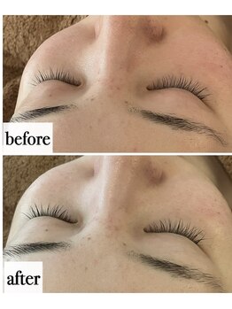 メナードフェイシャルサロン 岐阜茜部/ダブルビタQパック