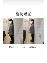 心斎橋長堀フェムテック整骨院/8姿勢矯正　骨格矯正と骨盤矯正