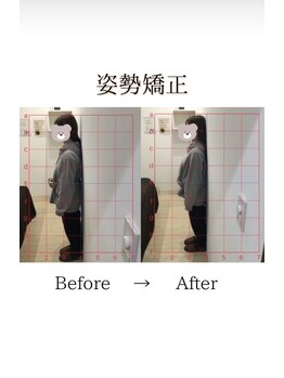 心斎橋長堀フェムテック整骨院/8姿勢矯正　骨格矯正と骨盤矯正