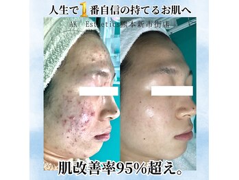 エーケーエステティックス 熊本新市街店(AK Esthetics)