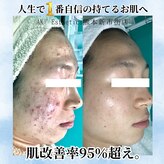 エーケーエステティックス 熊本新市街店(AK Esthetics)