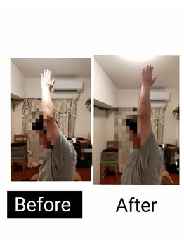 アース エンジェル整体院/ビフォアフ 肩こり ストレッチ