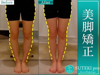 美骨矯正 ステキプロ(SUTEKI pro)/骨盤矯正で美脚を叶える