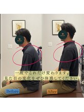 ユア(your.)/一度の猫背矯正で☆