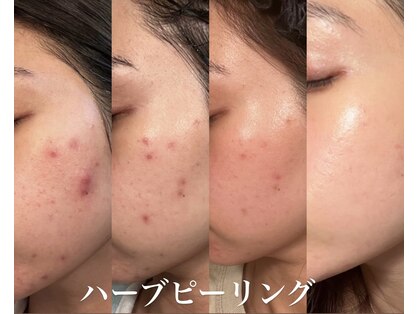 クレア(Claire)の写真