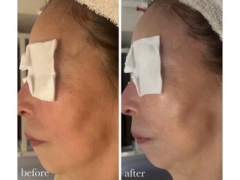 サロン ド ラム/［PDTコース］初回