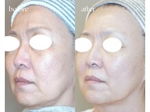 岩川治療院/５０代半ば　女性のお客様