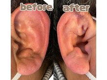 サロンド アヤメン(SALON DE AYAMEN)/耳毛脱毛
