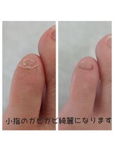 カーニバルマニア 三田店(Carnival Mania)/育爪フットケア