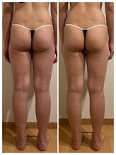 ココロ(Cocoro)/むくみ改善で内もものスキマが！