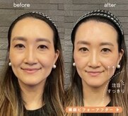 長寿鍼灸院 長寿整骨院