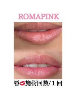 サラ/ローマピンク