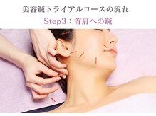 シー バイ カリスタ 銀座一丁目店(C by CALISTA)/美容鍼トライアルコースの流れ